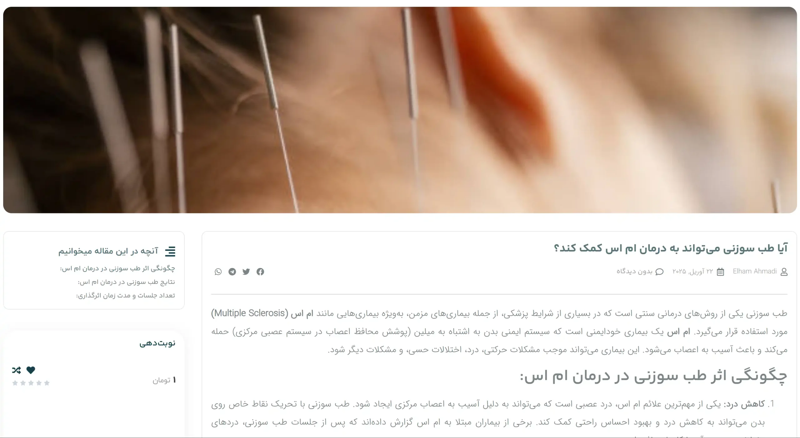 طراحی سایت طب سوزنی با رزرو نوبت آنلاین